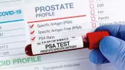 Landmark Study: Prostate Cancer Screening Could Slash Deaths by 13% in UK