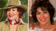 Ruby Wax Reveals Cosmetic Surgery Secrets at 72 in I'm A Celeb