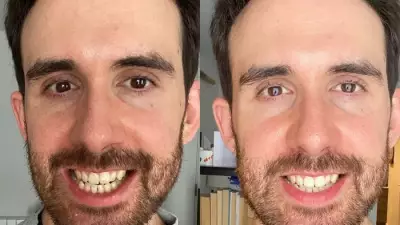 Festive Smile Boost: Teeth Whitening Strips Slashed to Under £10