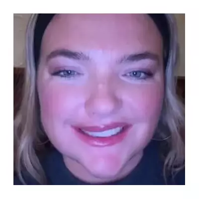 Snus warning: TikTok user's face left lopsided by nicotine pouches