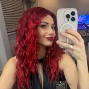 Dianne Buswell Reveals 'Extremely Painful' Pregnancy Symptoms on Strictly