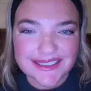 Snus warning: TikTok user's face left lopsided by nicotine pouches
