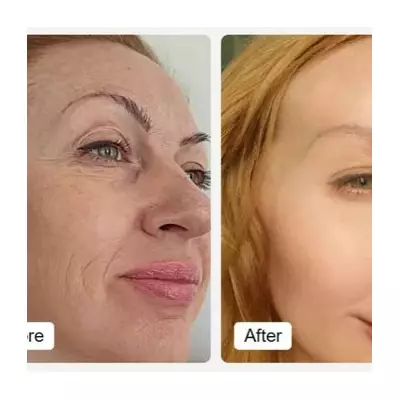 Save £400 on LED Face Mask with 80% Off Partner Deal