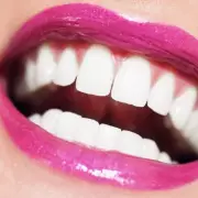 Amazon's £10 Whitening Strips 'Actually Work' & Leave Teeth 'Brighter'