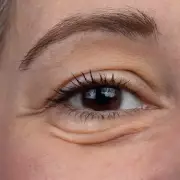 Boots' £10.99 Eye Cream Fights Dark Circles With Surprising Coffee Ingredient