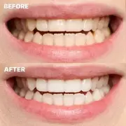 Dentist Reveals 36p-a-Day Teeth Whitening Method Among Three Stain-Free Tips