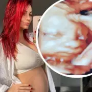 Dianne Buswell Shares First 4D Scan of Baby Boy: 'Extremely Grateful'