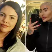 Family Demands Brazilian Butt Lift Ban After Mum's Death Linked to 'Lip King'