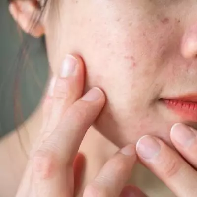 Dermatologist Endorses British Skincare Brand 47 Skin for Acne and Scar Treatment