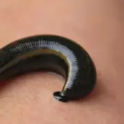 Birmingham Clinic Pioneers Leech Therapy for Modern Wellbeing and Health