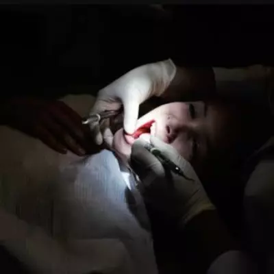 Birmingham Children's Teeth Crisis: Some Kids Need 15 Extractions