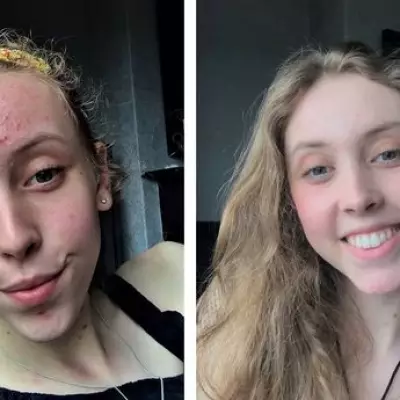 Brides-to-be praise £16 'miracle' acne serum as wedding skincare solution