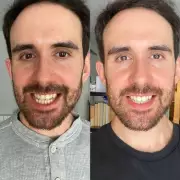 27p-a-Day Dentist-Approved Teeth Whitening Kit Saves Shoppers Hygienist Visits