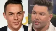 Bobby Norris Reveals Real Reason for Facelift in Emotional Interview