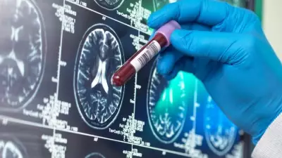 Blood Test Could Detect Alzheimer's Decades Before Symptoms