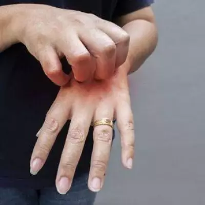 DWP Lists 24 Skin Conditions for £114 Weekly PIP Payment