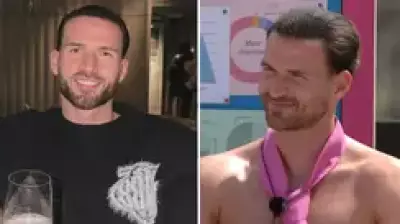 Love Island's Ronnie Vint Reveals Hair Transplant Results in Before and After Pics