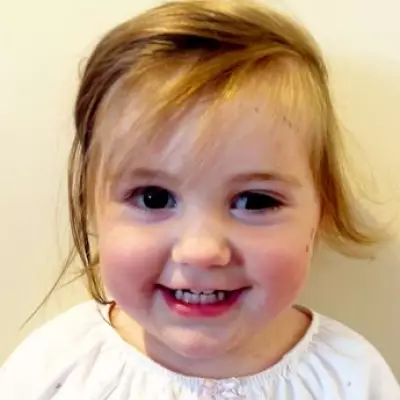 Mother's Photo Reveals Daughter's Rare Eye Cancer Symptom