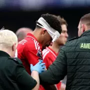 Morgan Gibbs-White shows head wound before Aston Villa Europa League clash