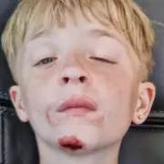 Police Urge Public to Call 999 If They Spot Missing Wollescote Boy, 12
