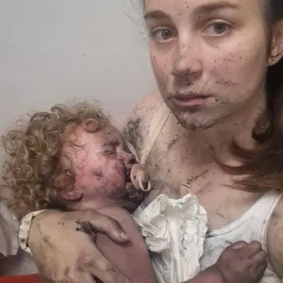 Shropshire Mum Warns After Toddler Poisoned by Common Garden Plant