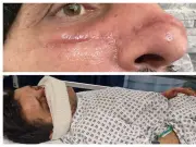 Father slashed across face in Perry Barr phone mugging ordeal