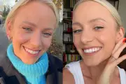 Quick 30-Minute Beauty Treatment Promises Holiday-Ready Smile