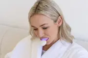 SmilePro LED Mouthguard: Affordable Teeth Whitening Results in Birmingham