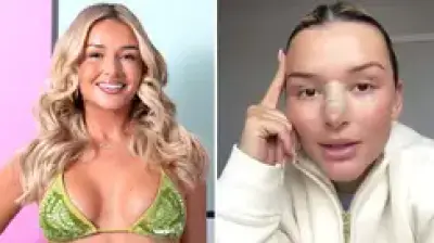 Love Island's Charleen Murphy Reveals All Cosmetic Surgery in TikTok Transparency Video