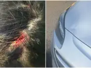 Birmingham teen suffers fractured spine after being hit by unmarked police car