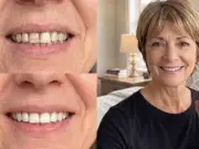 Family Asked If My Teeth Were Whitened – 32p-Per-Use Powder Gets Rave Reviews