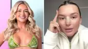 Love Island's Charleen Murphy Reveals All Cosmetic Surgery in TikTok Transparency Video