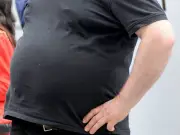 Obesity's Profound Effects on Careers: Thousands Out of Work, Study Finds