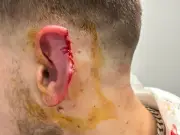 Solihull Popworld ear bite victim still waiting for justice 16 months on