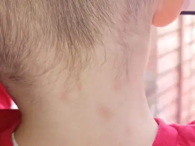 Wolverhampton mum begs to leave home as bed bugs force family to sleep on floor